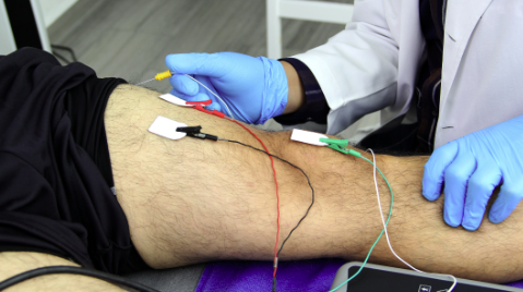 Electromiografía con electrodos en la pierna