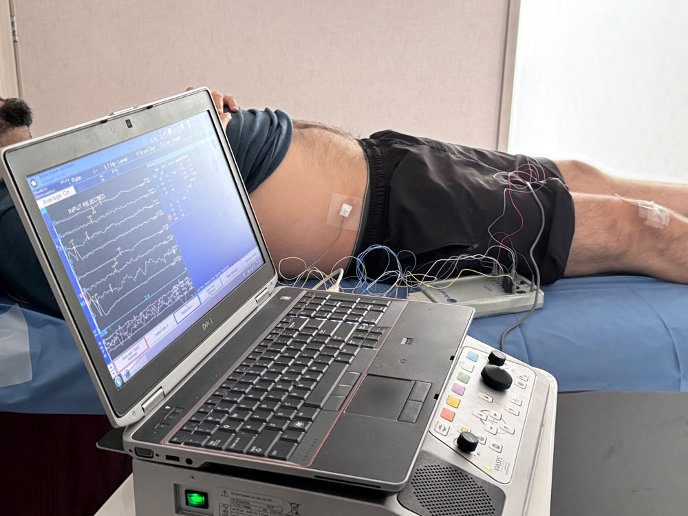 Potenciales evocados somatosensoriales con electrodos y registro en computadora