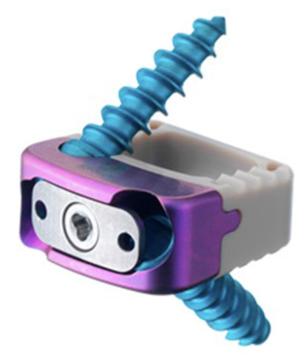 Velofix™ SA — Caja cervical bloqueada